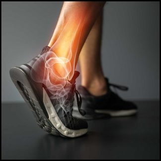 Arthritis / Joint and Bone